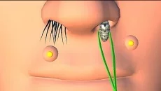 Face Clinic - дата выхода для Android